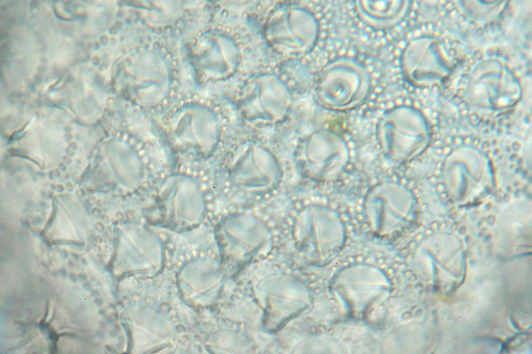 [ BUGA tardigrade egg, detail ]
