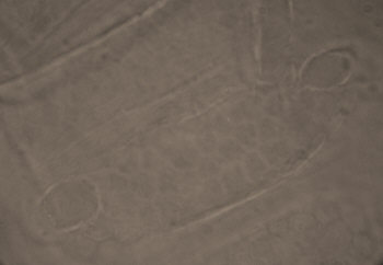 [ Ramazzottius oberhaeuseri, cuticula, detail ]