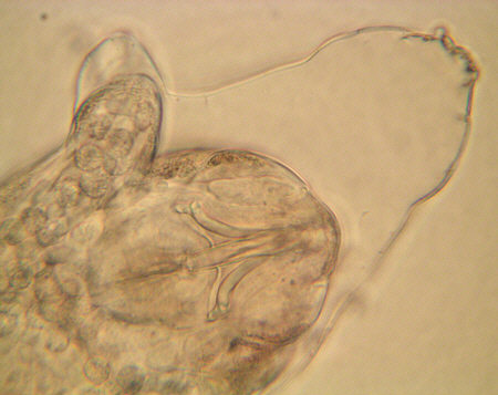 [ Tardigrade; asphyctic state ]