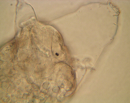 [ Tardigrade; asphyctic state ]