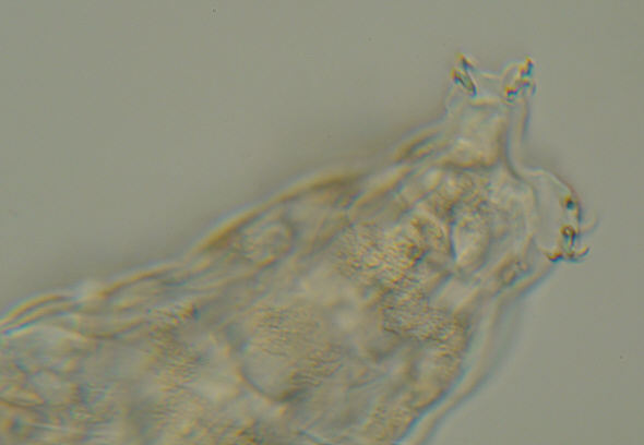 [ B&auml;rtierchen von einem Mammutbaum, letztes Beinpaar ]