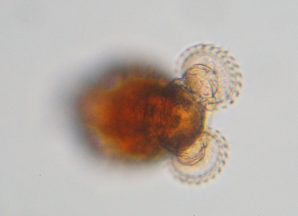 [ Krka National Park, Croatia: rotifer ]