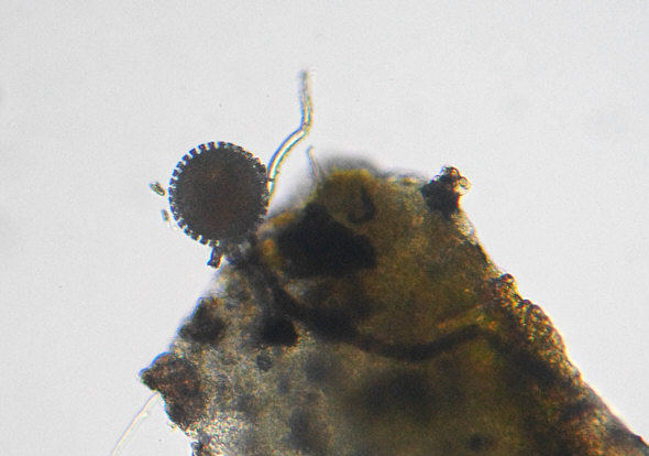 [ Krka National Park, Croatia, Eutardigrade egg ]