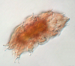 [B&auml;rtierchen, Tardigrade, jugendlich]