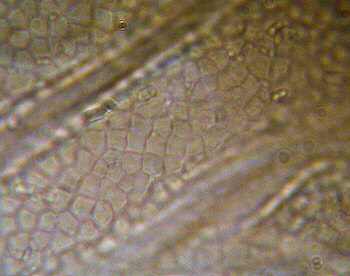 [ Cuticula of Ramazzottius oberhaeuseri ]