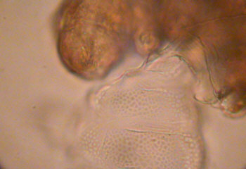 [ Ramazzottius oberhaeuseri after moulting ]