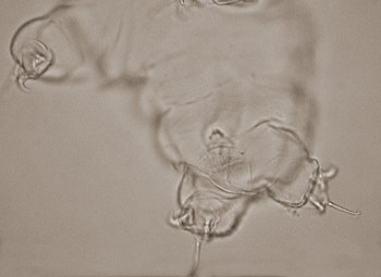 [ Cuticula of Ramazzottius oberhaeuseri ]