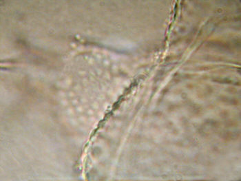 [ Cuticula of Ramazzottius oberhaeuseri ]