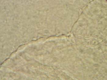 [ Cuticula of  Ramazzottius oberhaeuseri ]