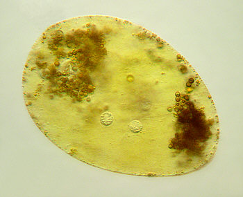 [ Echiniscus tardigrade, stomach content ]