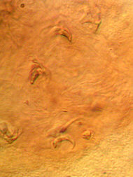 [ Tardigrade stomach: claws od a tiny devoured tardigrade) ]