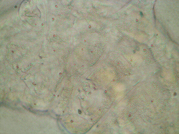 [ tardigrade (phylum tardigrada)]