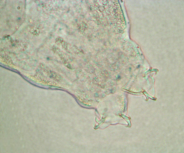 [ tardigrade (phylum tardigrada) ]