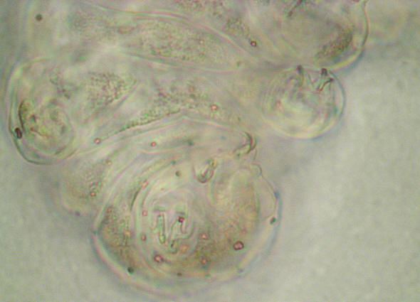 [ tardigrade (phylum tardigrada)]