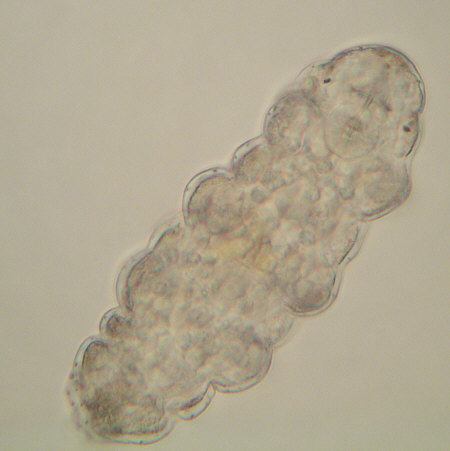 [ tardigrade (phylum tardigrada) ]
