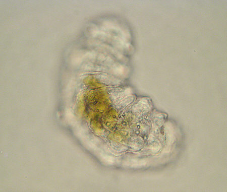 [ tardigrade (phylum tardigrada) ]