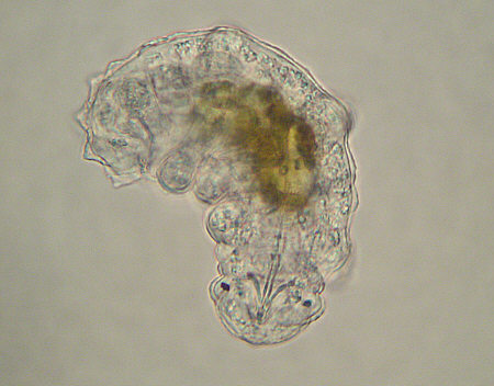 [ tardigrade (phylum tardigrada) ]