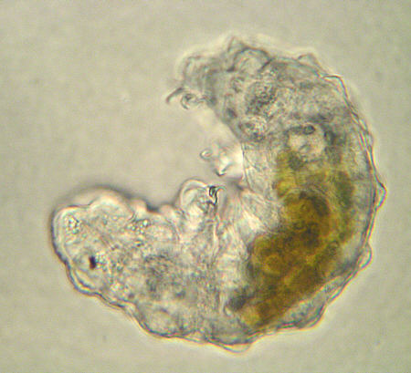 [ tardigrade (phylum tardigrada) ]