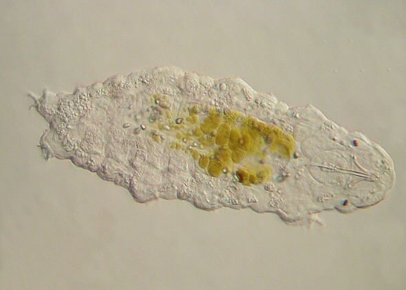 [ tardigrade (phylum tardigrada) ]