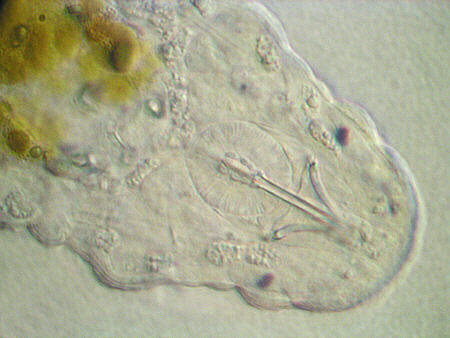 [ tardigrade (phylum tardigrada) ]