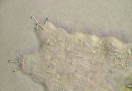 [ tardigrade (phylum tardigrada) ]