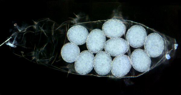 Eggs of &nbsp;Milnesium tardigradum&nbsp; water bear