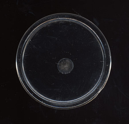 [ Anhydrobiose der B&auml;rtierchen (3) ]