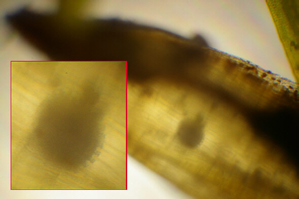 [ Capsule of a moss plant with tardigrade eggs ]