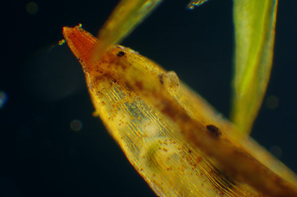 [ Capsule of a moss plant with tardigrade ]