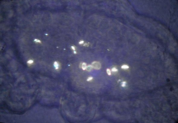 [ B&auml;rtierchen-Mageninhalt im polarisierten Licht ]