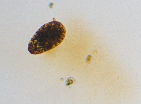 [ Krka National Park, tardigrade deposit ]