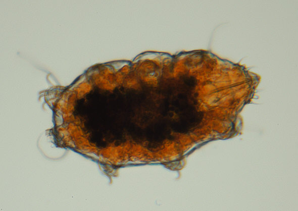 [ Krka National Park, Croatia, Echiniscus sp. tardigrade 1]