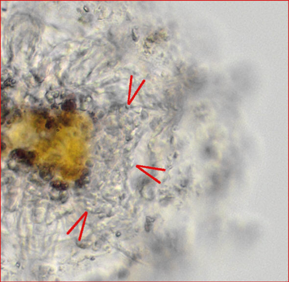 [ Florarctus male, detail ]