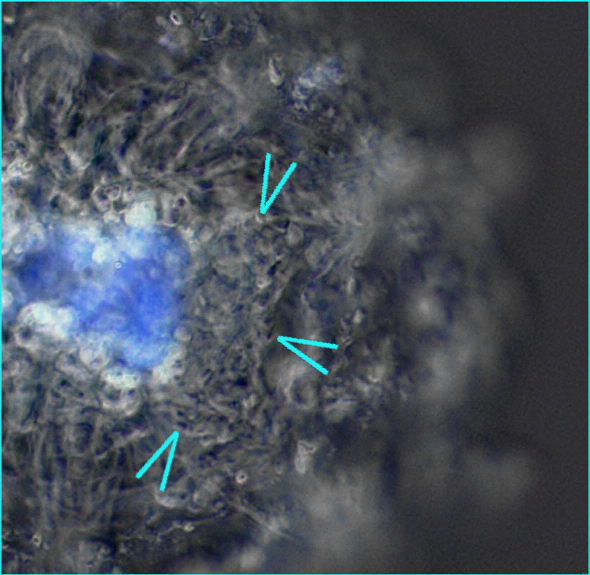 [ Florarctus male, detail, inverted colors ]