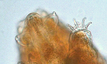 [tardigrades cornechiniscus cornutus]