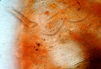tardigrades tardigrada b&auml;rtierchen detail echiniscus