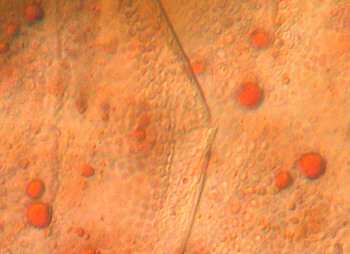 [senile water bear (tardigrade), detail]