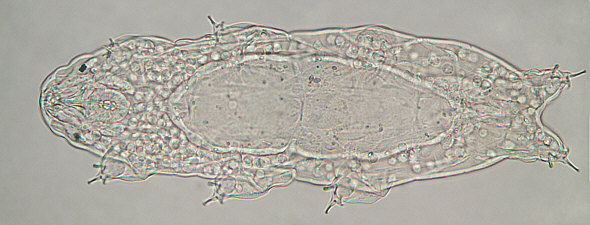 [ Tardigrade (Tardigrada) ]