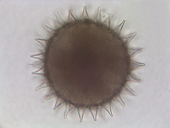 [ Tardigrade; unknown species; egg ]