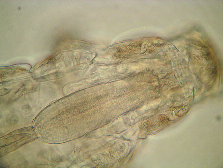 [ Milnesium tardigradum, Schlundkopf ]