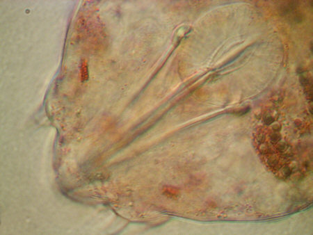 [ Echiniscus tardigrade from the Canary Islands; head region ]