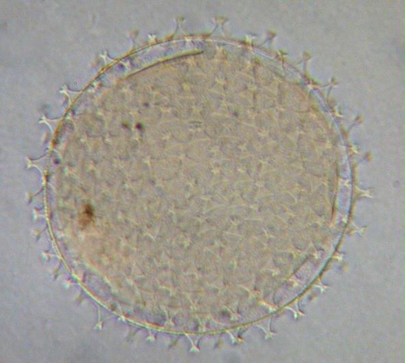 [ Macrobiotus sp. Ei ]