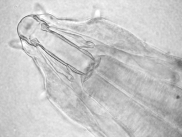 [ B&auml;rtierchenstilette: Milnesium tardigradum ]