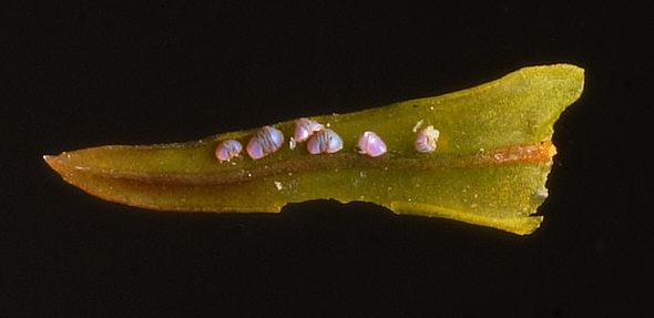 [ tardigrade image,  Sony Nex-5/bellows/'Noritsu' loupe objective ]