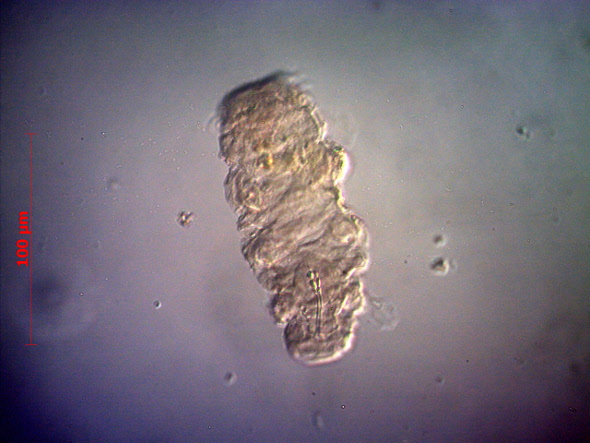 [ Kartoffel Tardigrade ]