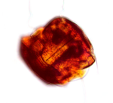 [ B�rtierchen, Genus Echiniscus ]