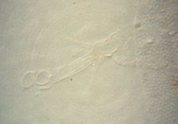 [ Baltic Sea tardigrade, detail: adhesive disks ]