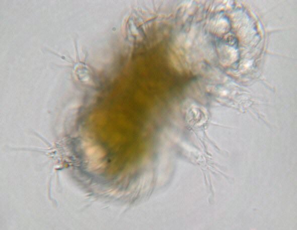 [ Baltic Sea tardigrade ]