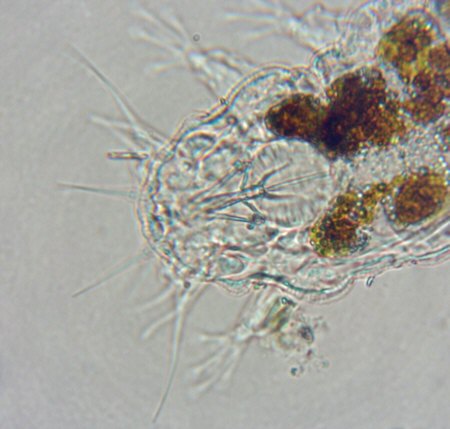 [ Baltic Sea tardigrade, detail view, head region ]