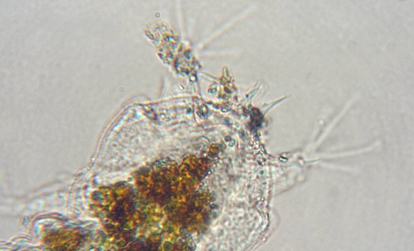 [ Baltic Sea tardigrade, detail view of hind body]